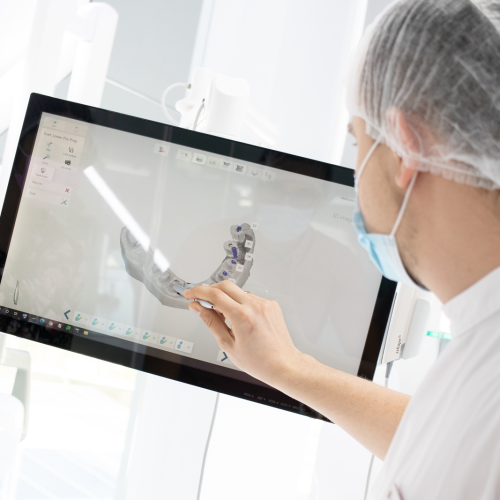 dentist-3d-3shape-scan-monitor
